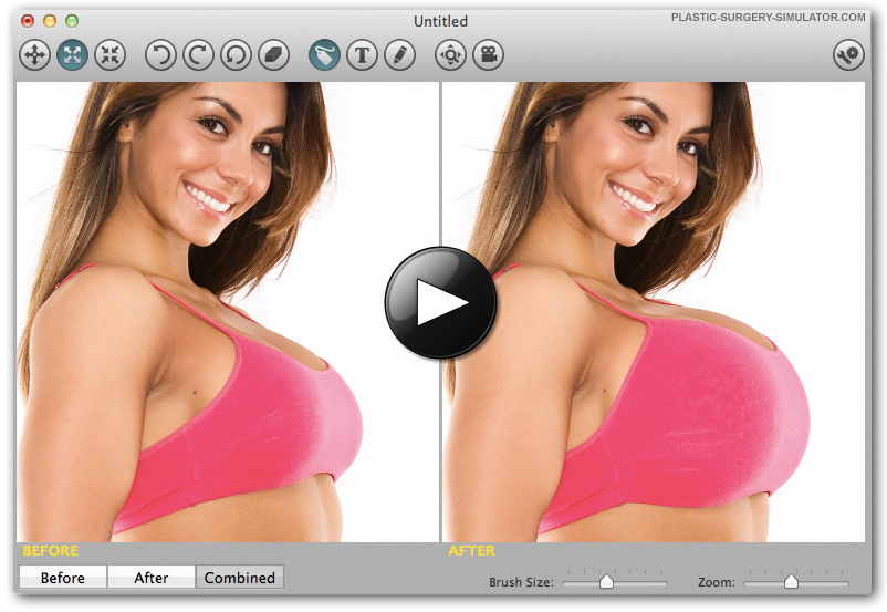 Plastic Surgery Simulator on Mac
