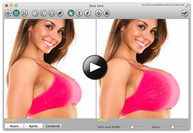 Plastic Surgery Simulator on Mac
