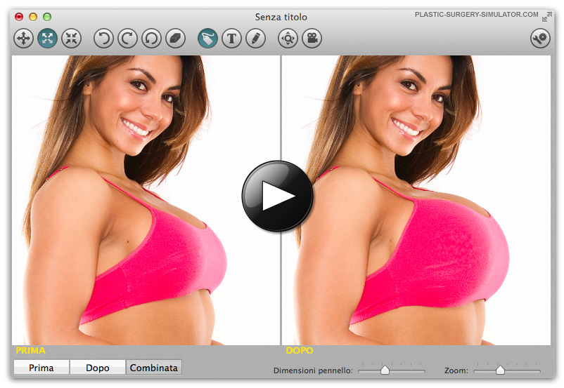 Simulatore di Chirurgia Plastica su Mac