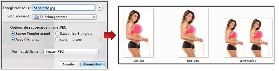 Sauvegarde Simulateur de Chirurgie Esthétique