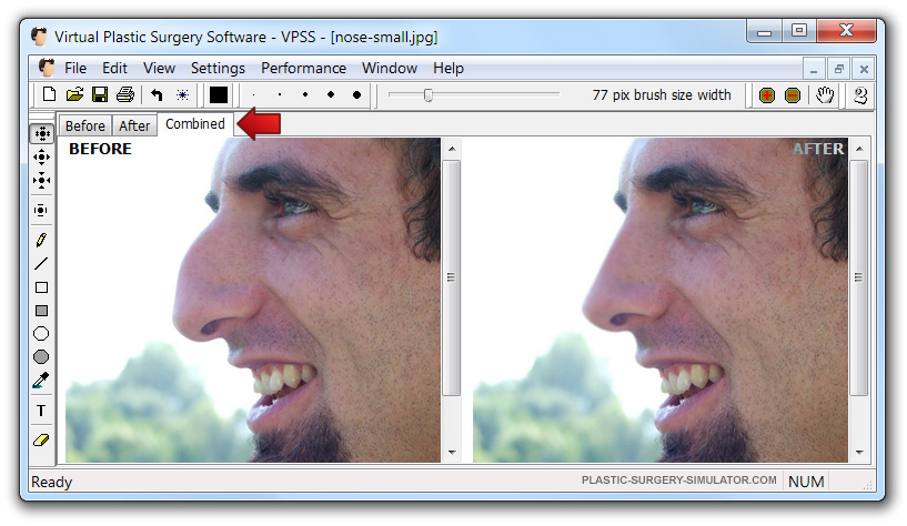 Abas do Simulador de Cirurgia Plástica no Windows
