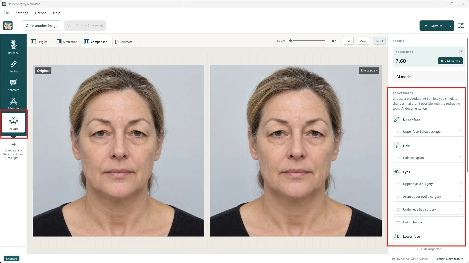 El inspector de la Edición IA con los procedimientos por zona: parte superior del rostro, cabello, ojos, parte inferior del rostro y dientes