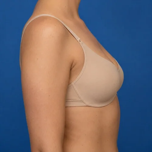 Profile of a woman's chest before the breast augmentation simulation