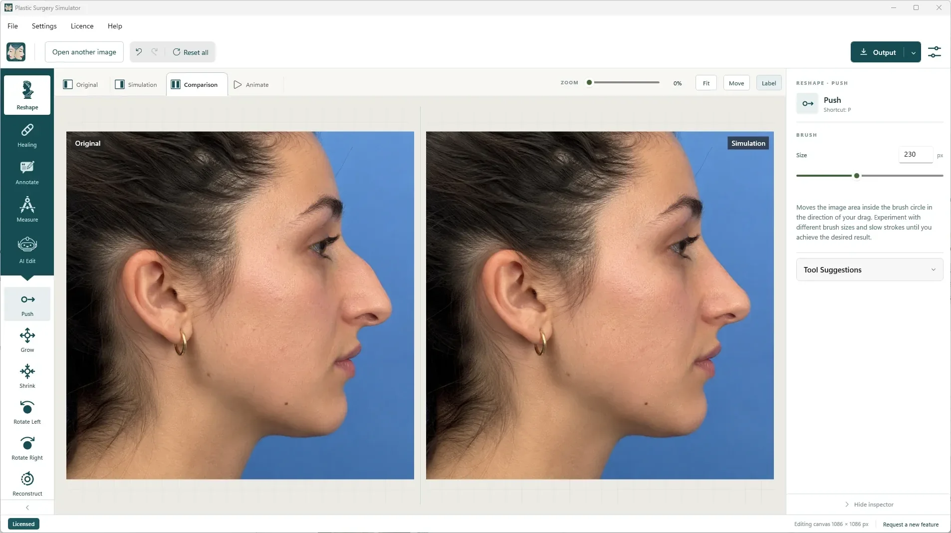 Editor do Plastic Surgery Simulator mostrando uma rinoplastia na guia Comparação, com a barra de ferramentas à esquerda e o inspetor à direita