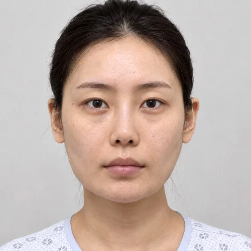 안면윤곽 시뮬레이션 후, 턱선이 부드럽고 갸름해진 같은 여성