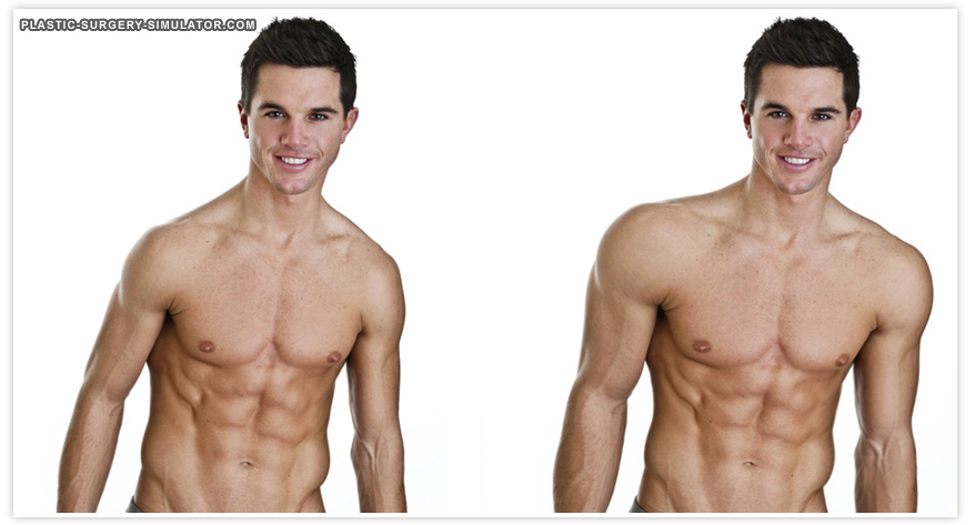 Plastic Surgery Simulator로 시뮬레이션한 근육 확대
